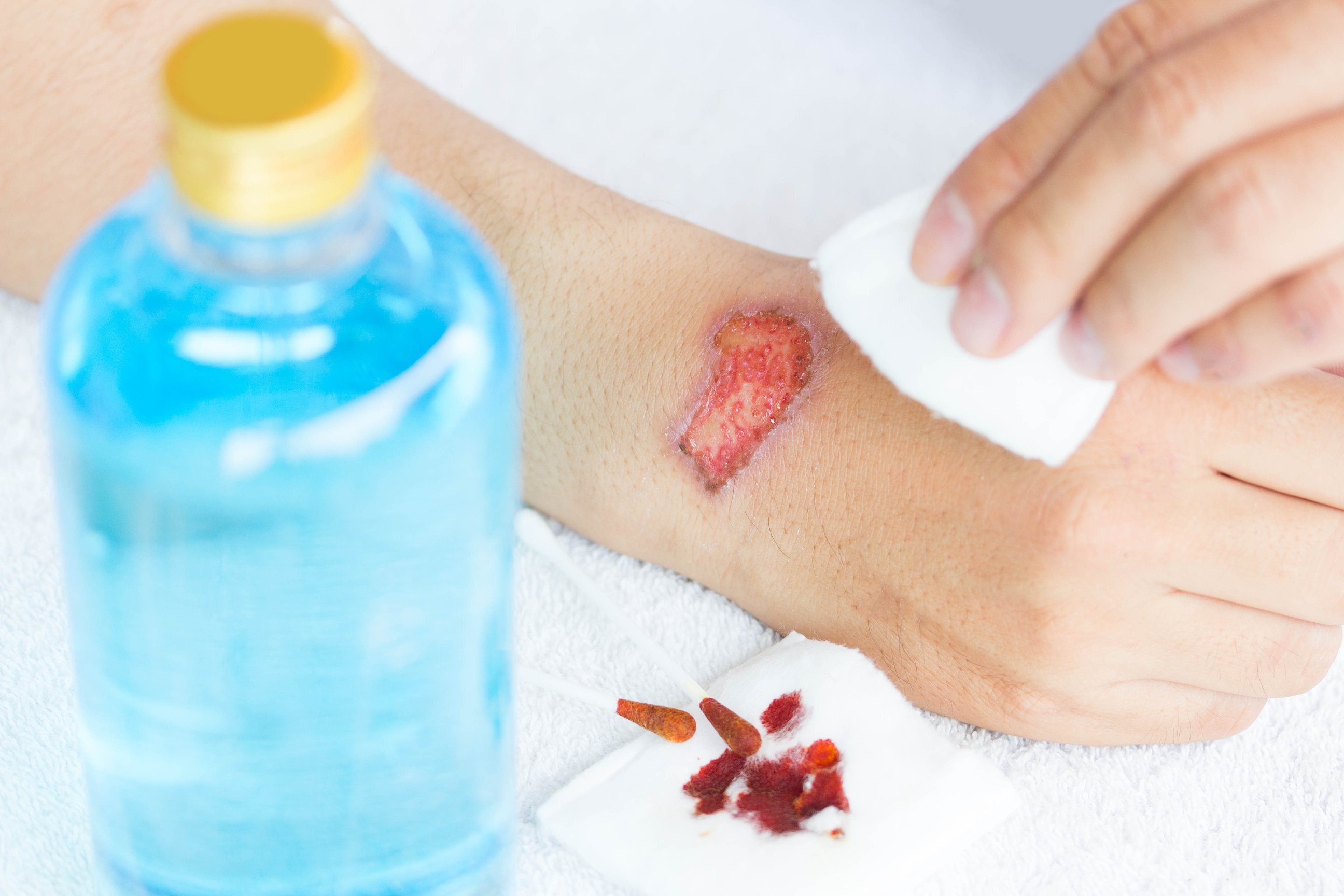 how-to-help-your-wounds-heal-the-medication-insider